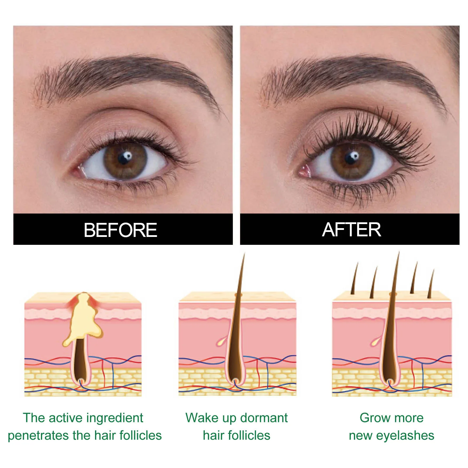 เซรั่มบำรุงขนตา 5 ชิ้น ไบโอติน - Lash Serum Growth บทวิจารณ์และราคา